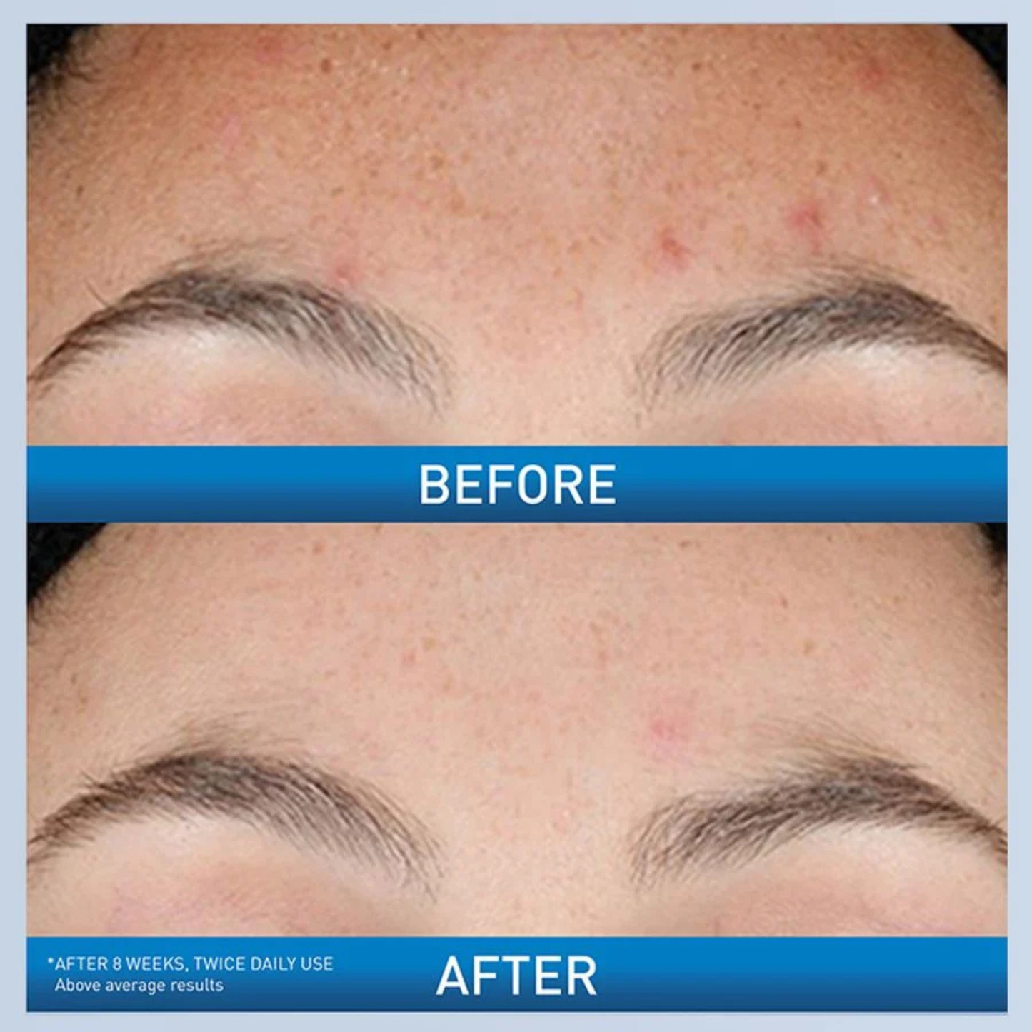 Resurfacing Retinol Serum 30ml