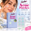 ORCHID, Parches para el acne (Estrellas)