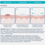 CeraVe Acne Control Patches - 22ct